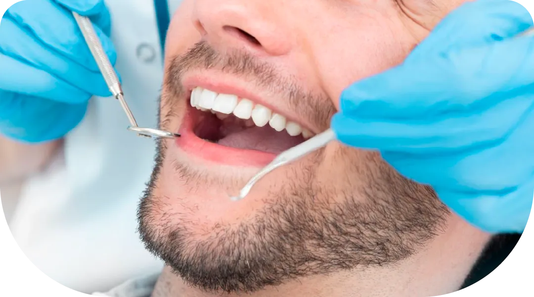 img-diseño-de-sonrisa