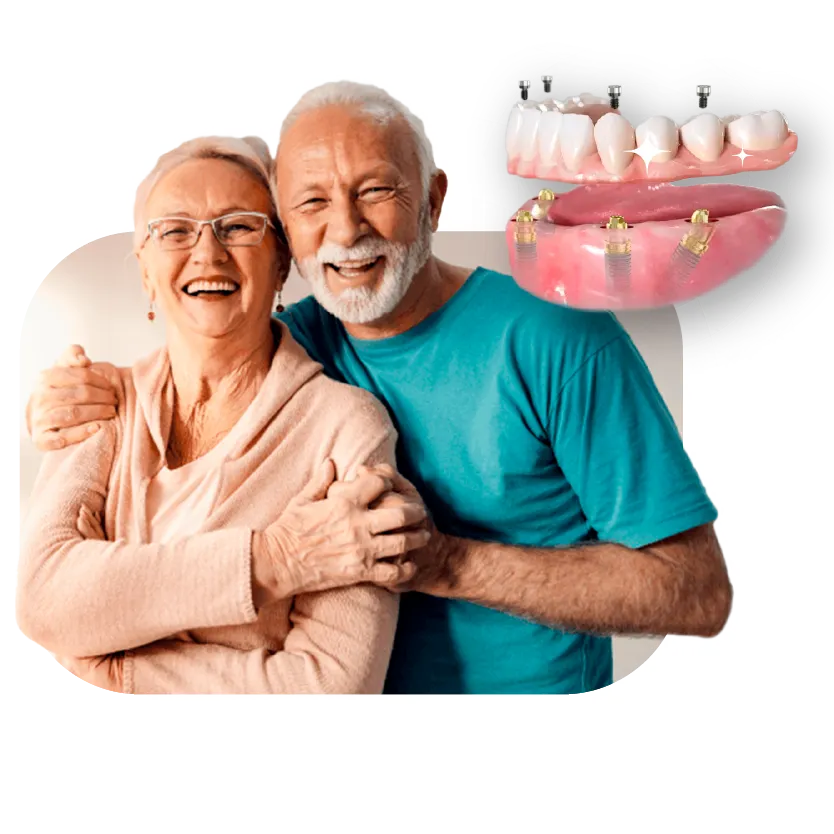Implantes-adultos-sonriendo
