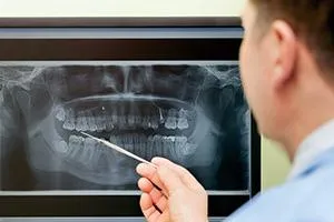 Digital X-ray result