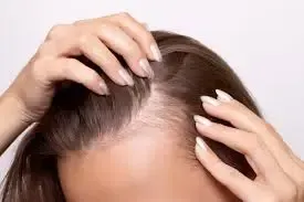 Thinning Hair?
