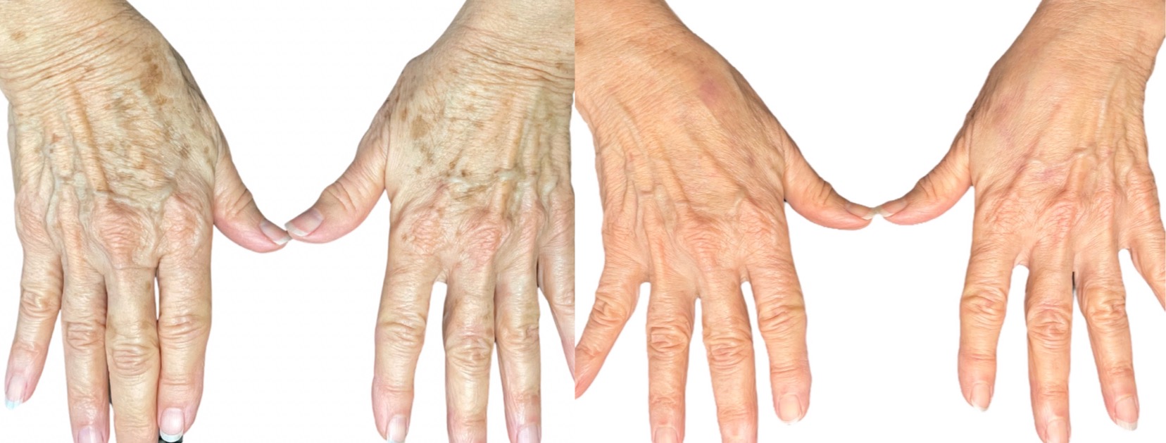 Why Your Skin Ages Differently After 45