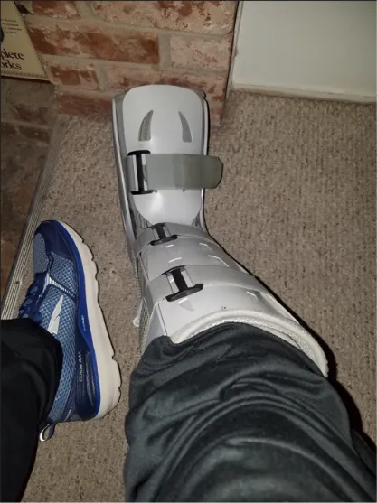 Coach Tim's foot in a walking boot after an injury