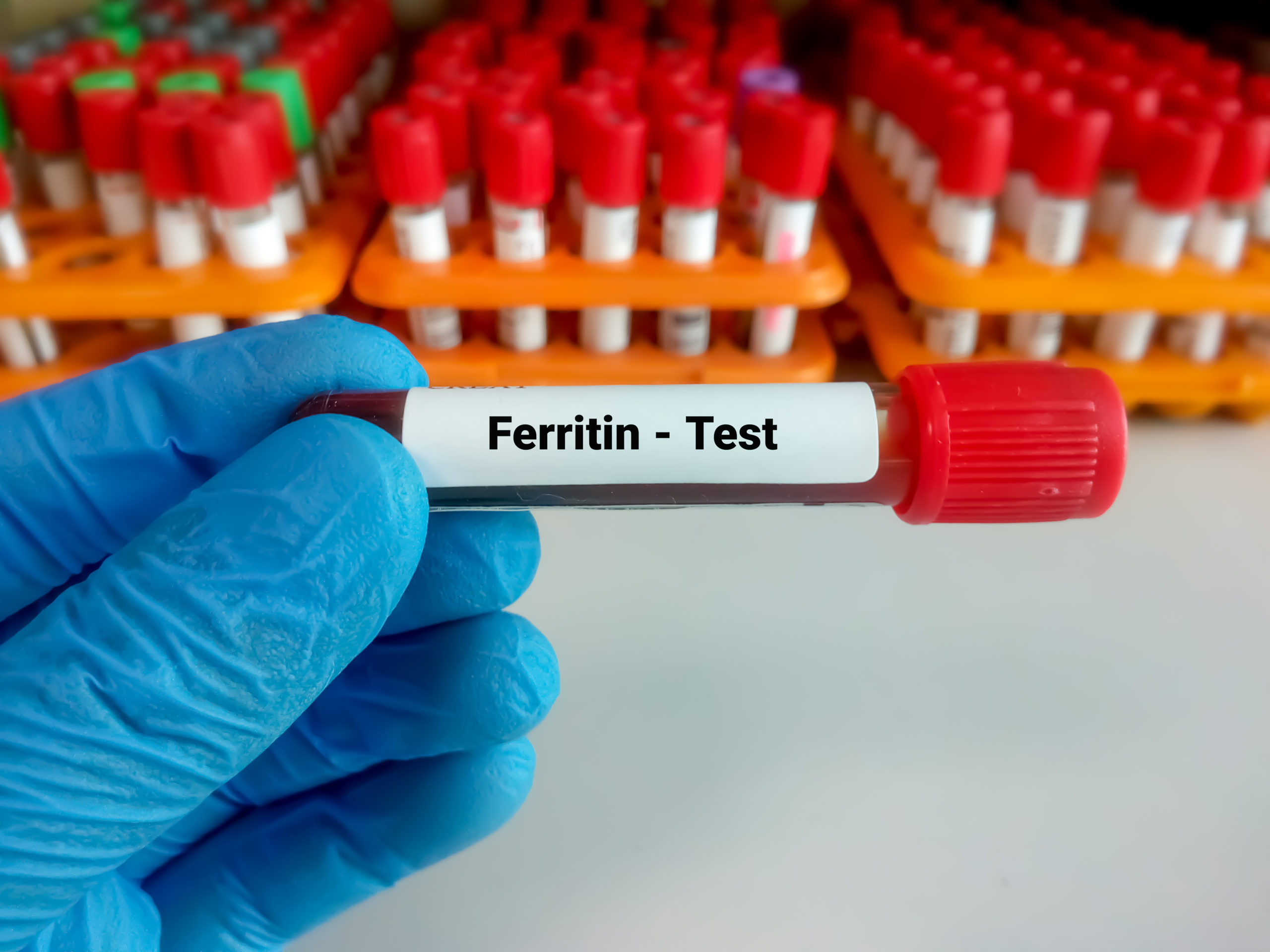 ferritin test
