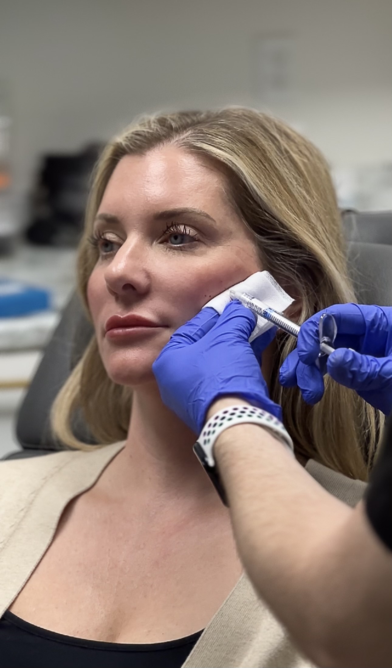 A woman is injected with dermal filler in her cheeks.