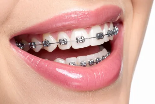 white and yellow wooden condiment shakers