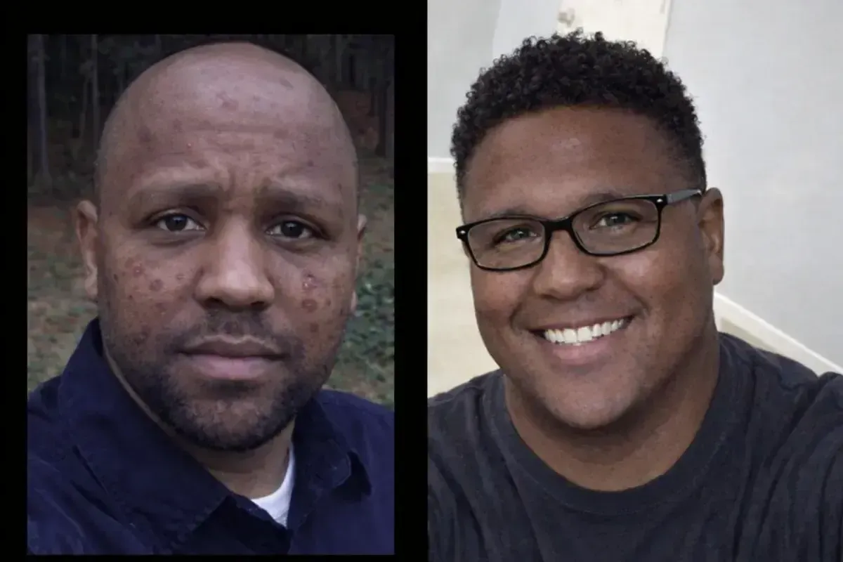 Patient's journey from opioid addiction to recovery with MAT at Medivira — before and after Suboxone treatment in Frisco TX