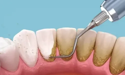 Dental Premium Nuestra Clinica Foto 1