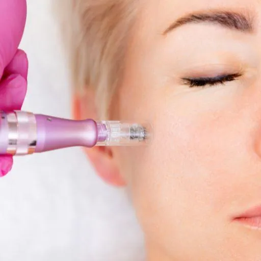 A close-up of a person receiving a microneedling treatment on their face by a professional wearing pink gloves.