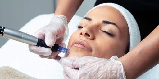 Woman receiving microneedling treatment on chin area at a skincare clinic.