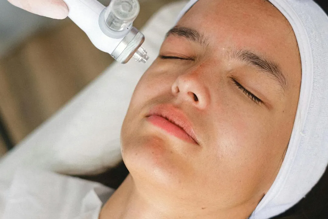 Close-up of woman receiving a cosmetic laser treatment, representing skin types and conditions suitable for laser hair removal sessions.