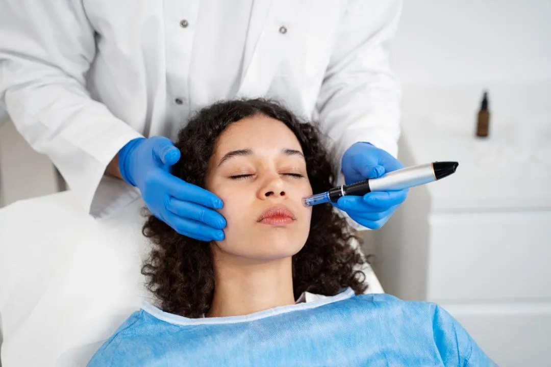 A woman undergoing a microneedling procedure on her cheek by a professional using a dermapen tool in a clinical skincare setting.