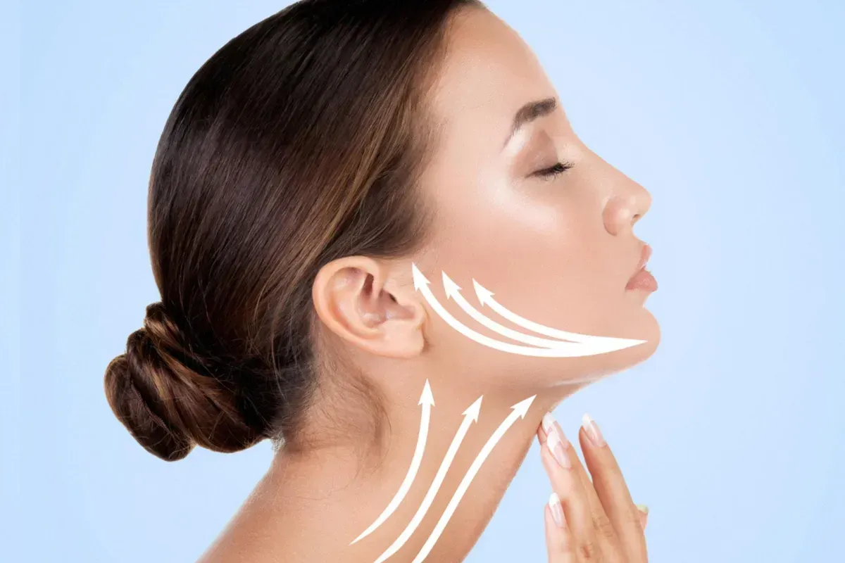 PDO Thread Lift in Temecula at LeVogue.