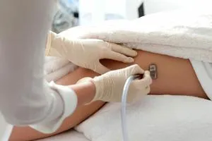 microdermabrasion