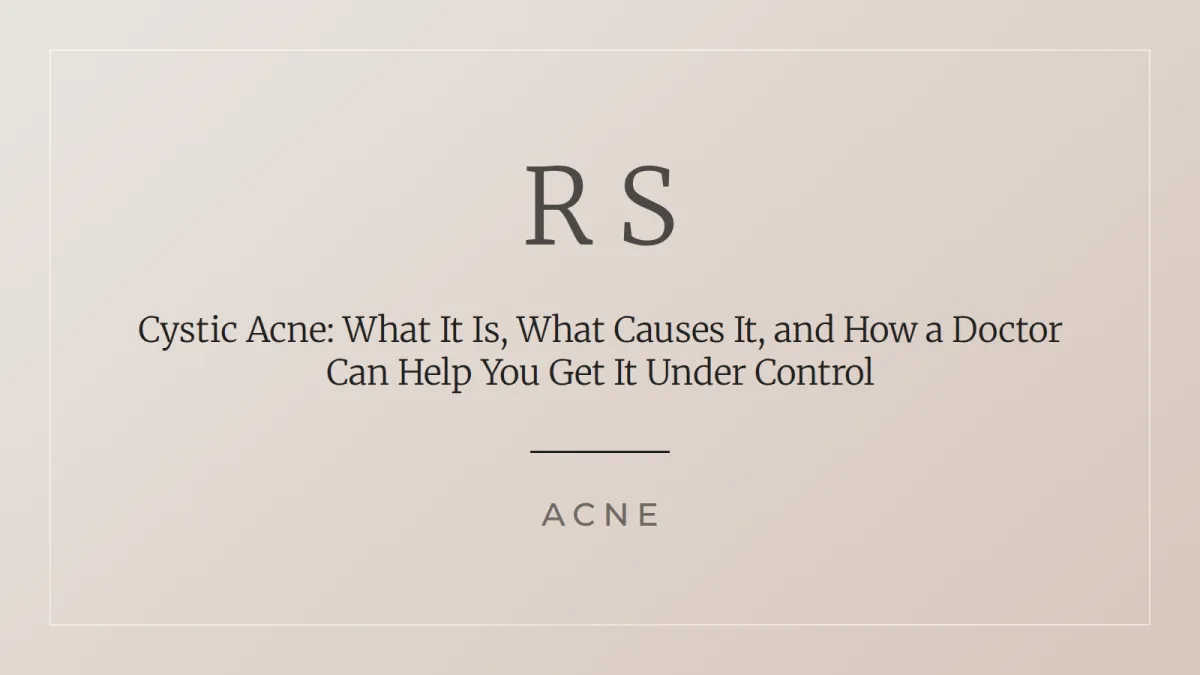 Cystic acne causes and doctor treatment guide Radiant Secrets SA