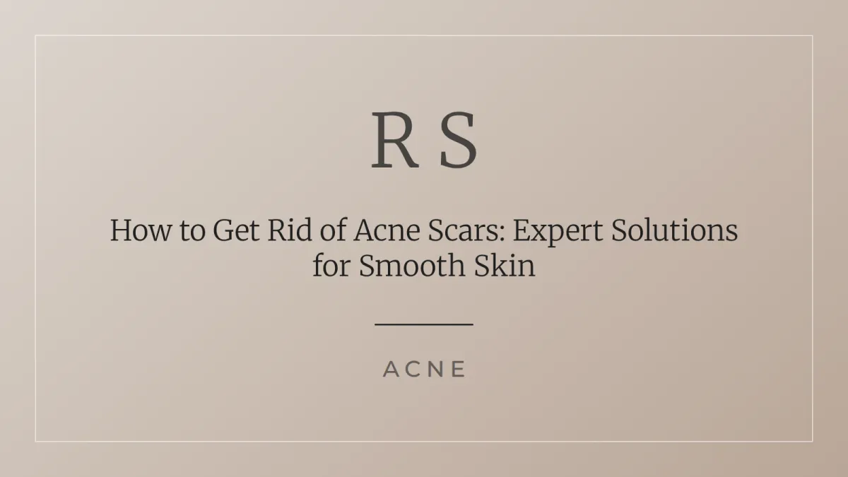 How to get rid of acne scars treatment guide Radiant Secrets SA