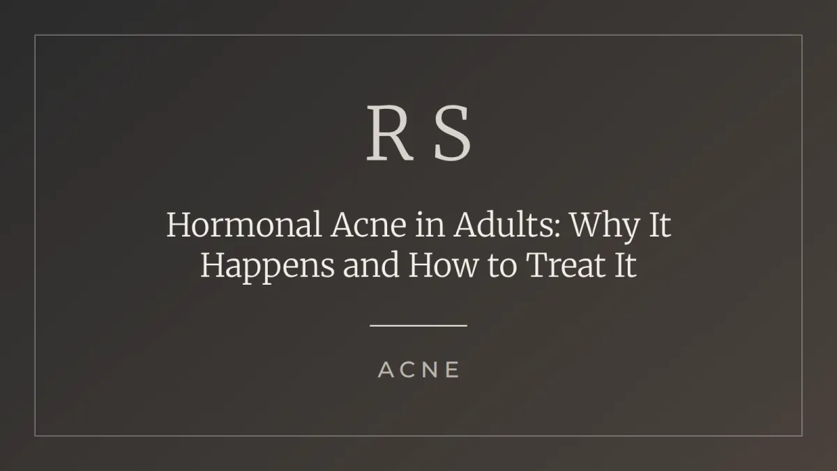 Hormonal acne in adults causes and treatment Radiant Secrets SA