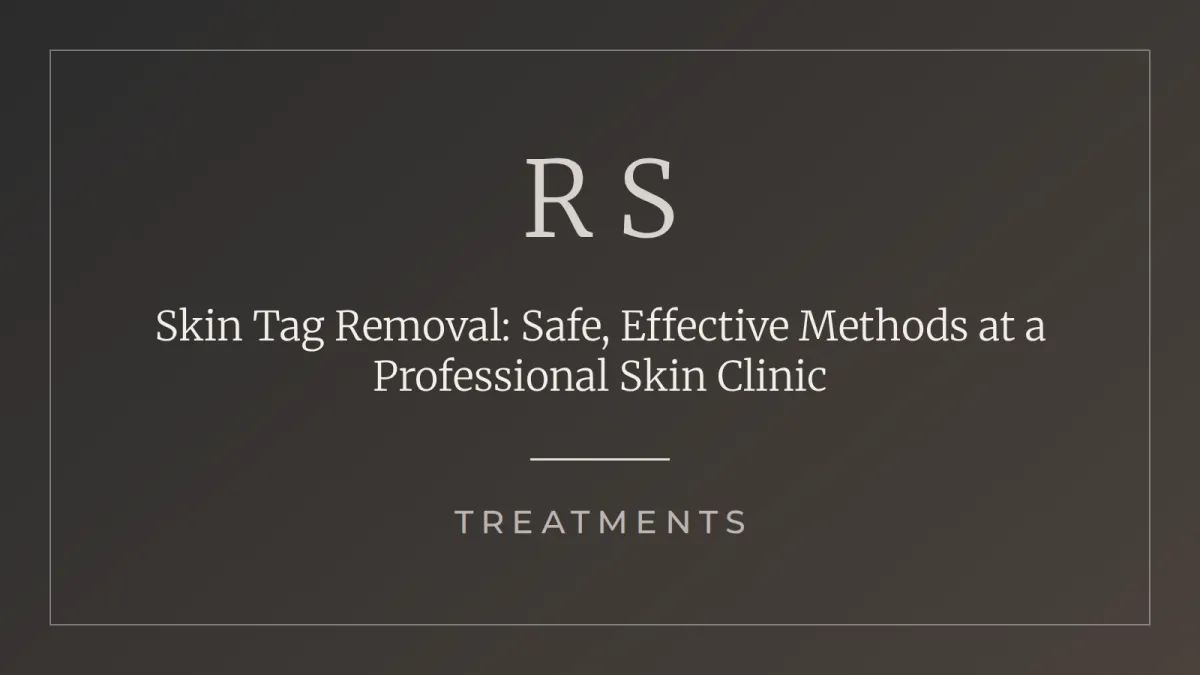Professional skin tag removal at Radiant Secrets skin clinic in Illovo Johannesburg
