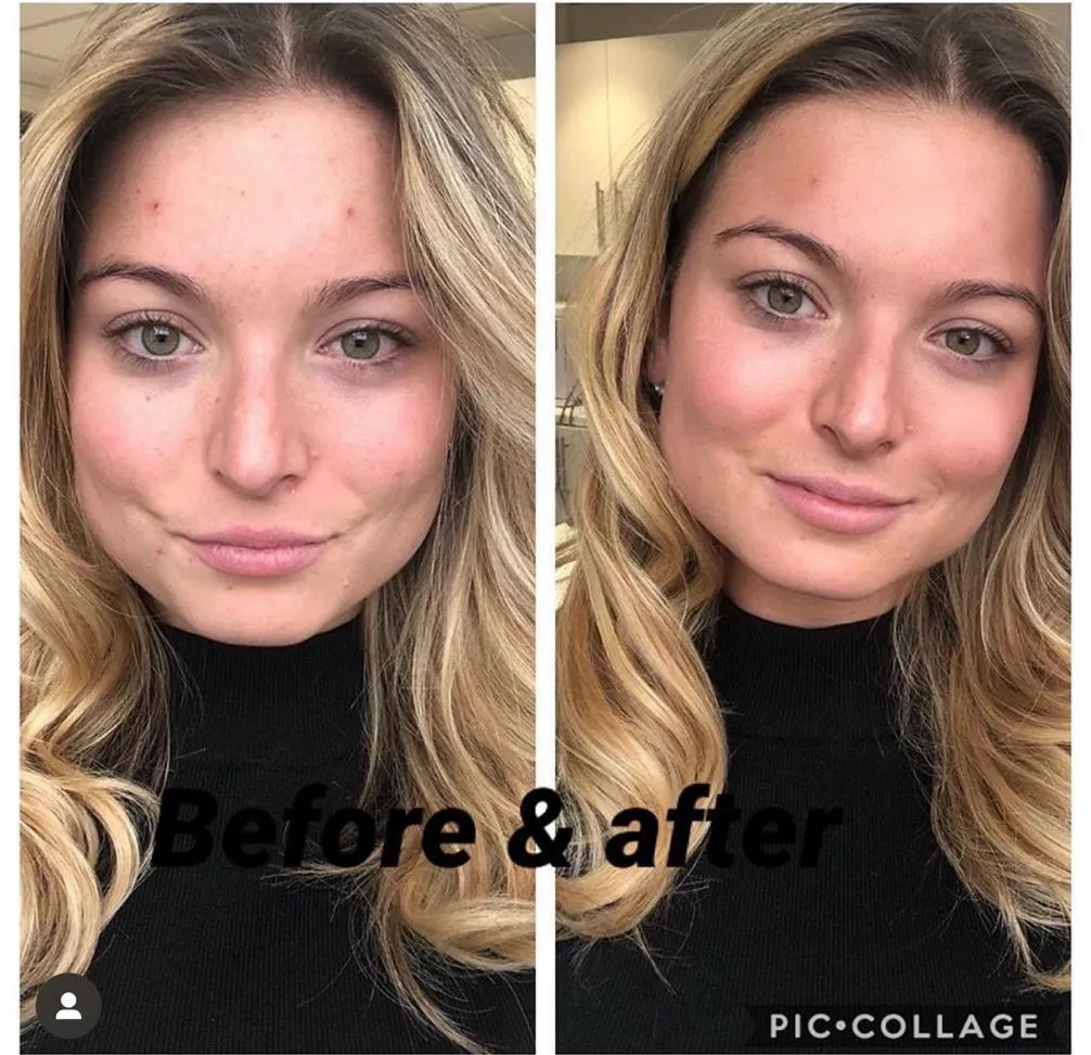 Client before and after result