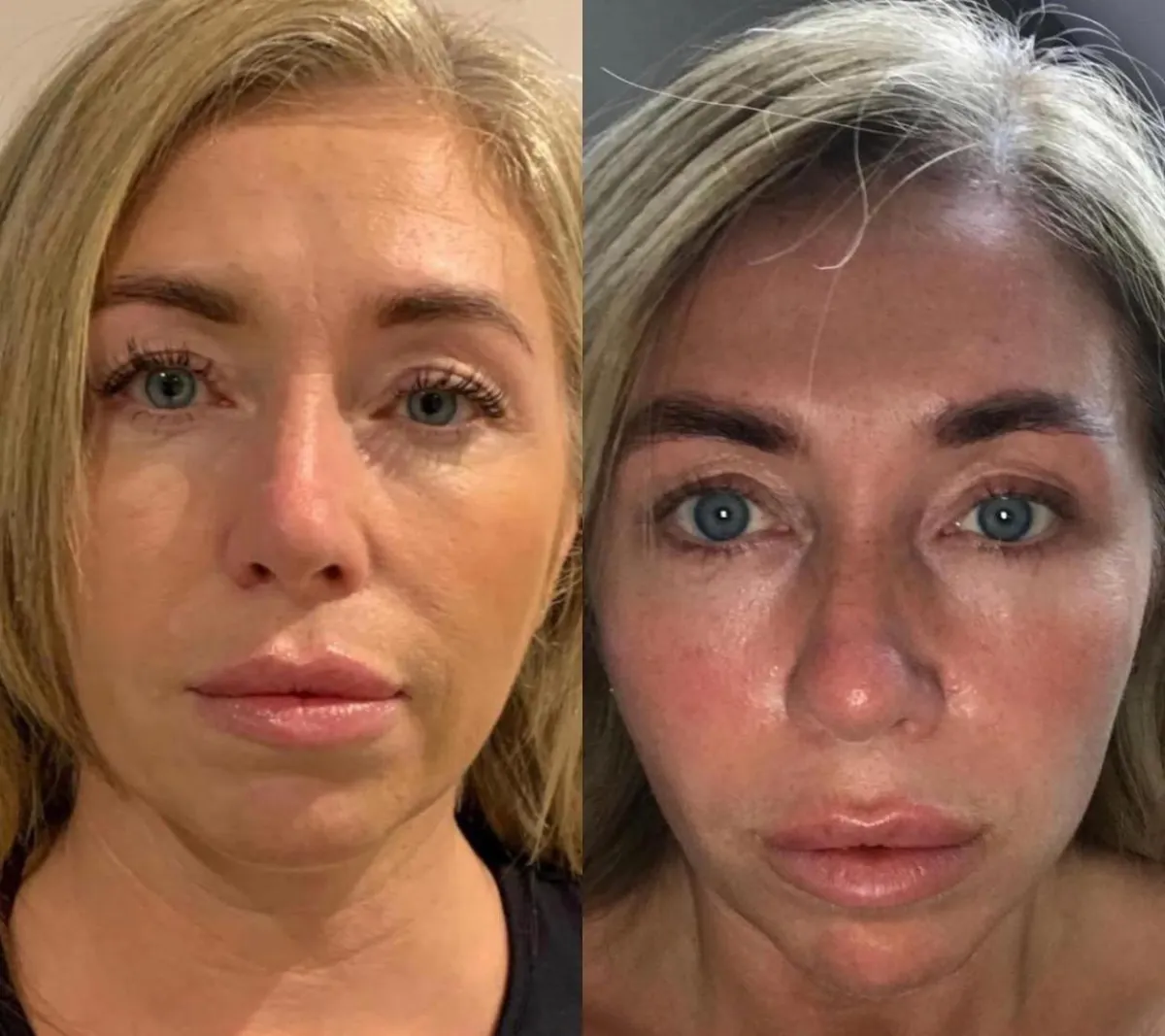 Client before and after result