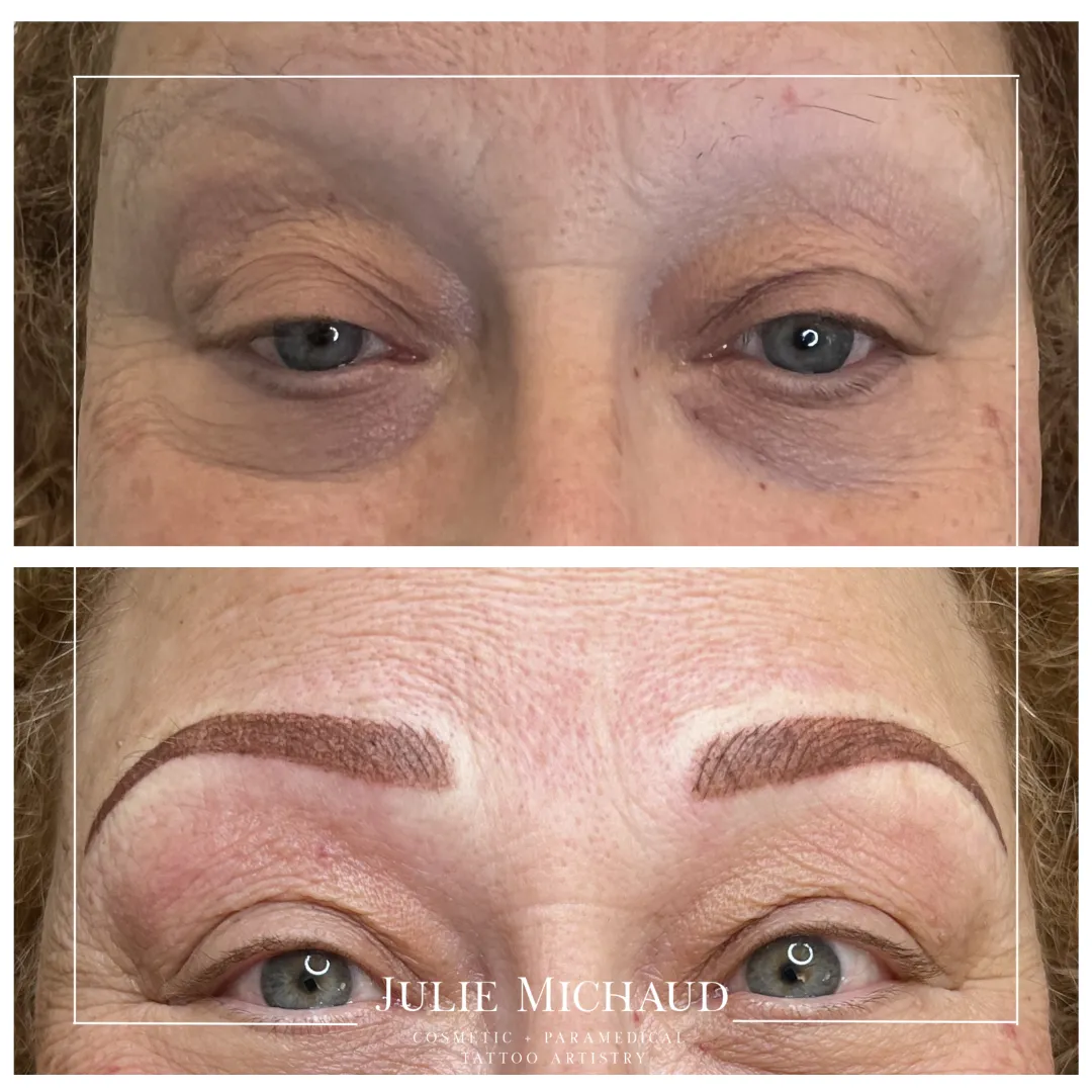 Before and after cosmetic tattooing brows with soft shading and natural-looking fullness.