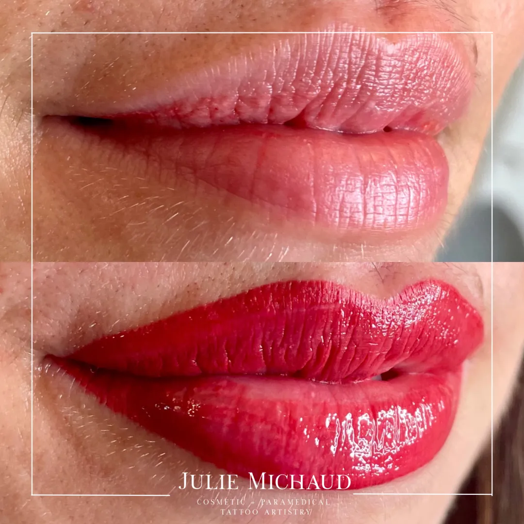 Before and after lip blush cosmetic tattooing showing enhanced natural lip color and improved definition.