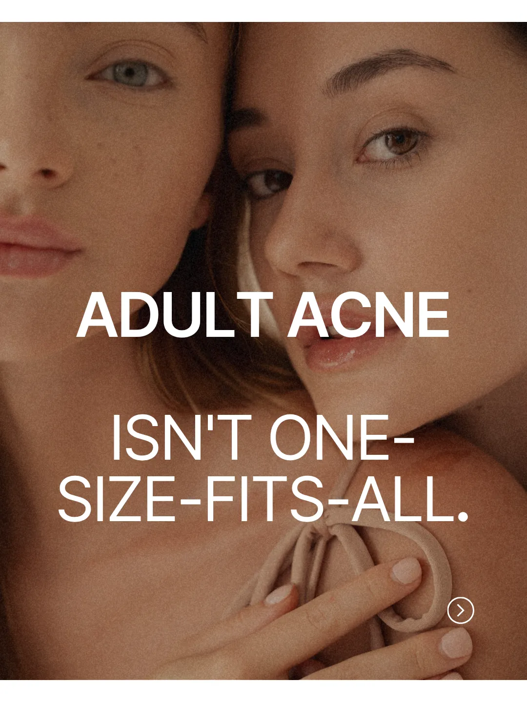 adult acne isn't one size fits all
