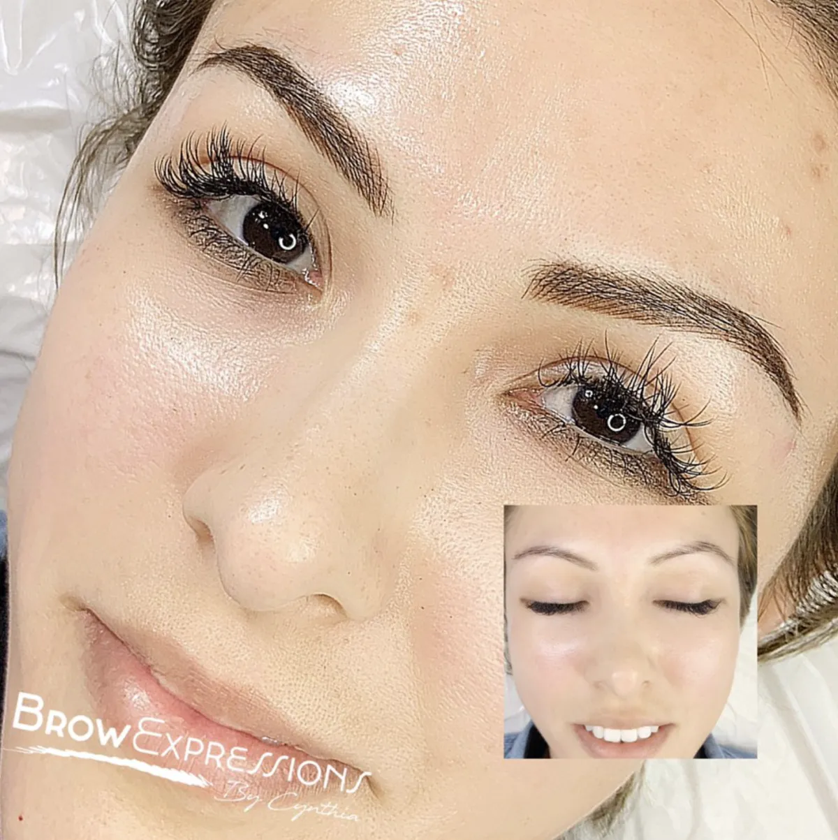 Impressive before and after of Los Angeles microblading eyebrow treatment