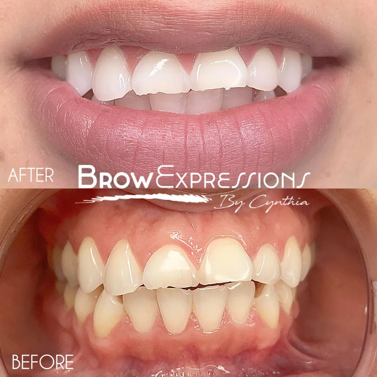 1 hour teeth whitening training