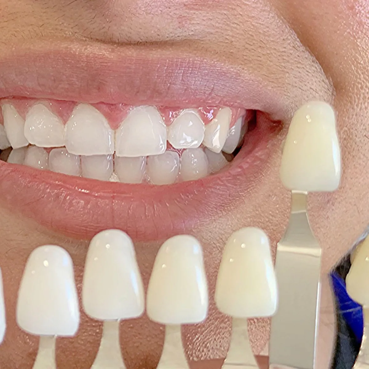 best online teeth whitening training