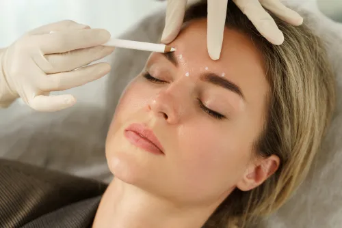 dermal fillers st pete bradenton