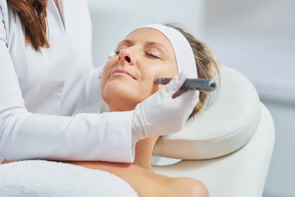 microneedling treatment