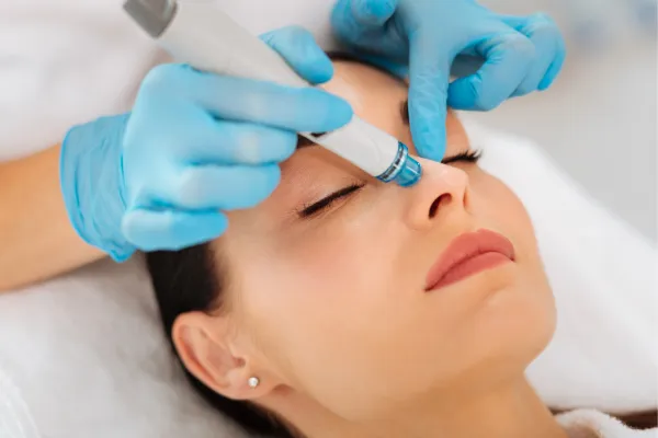 microneedling bradenton