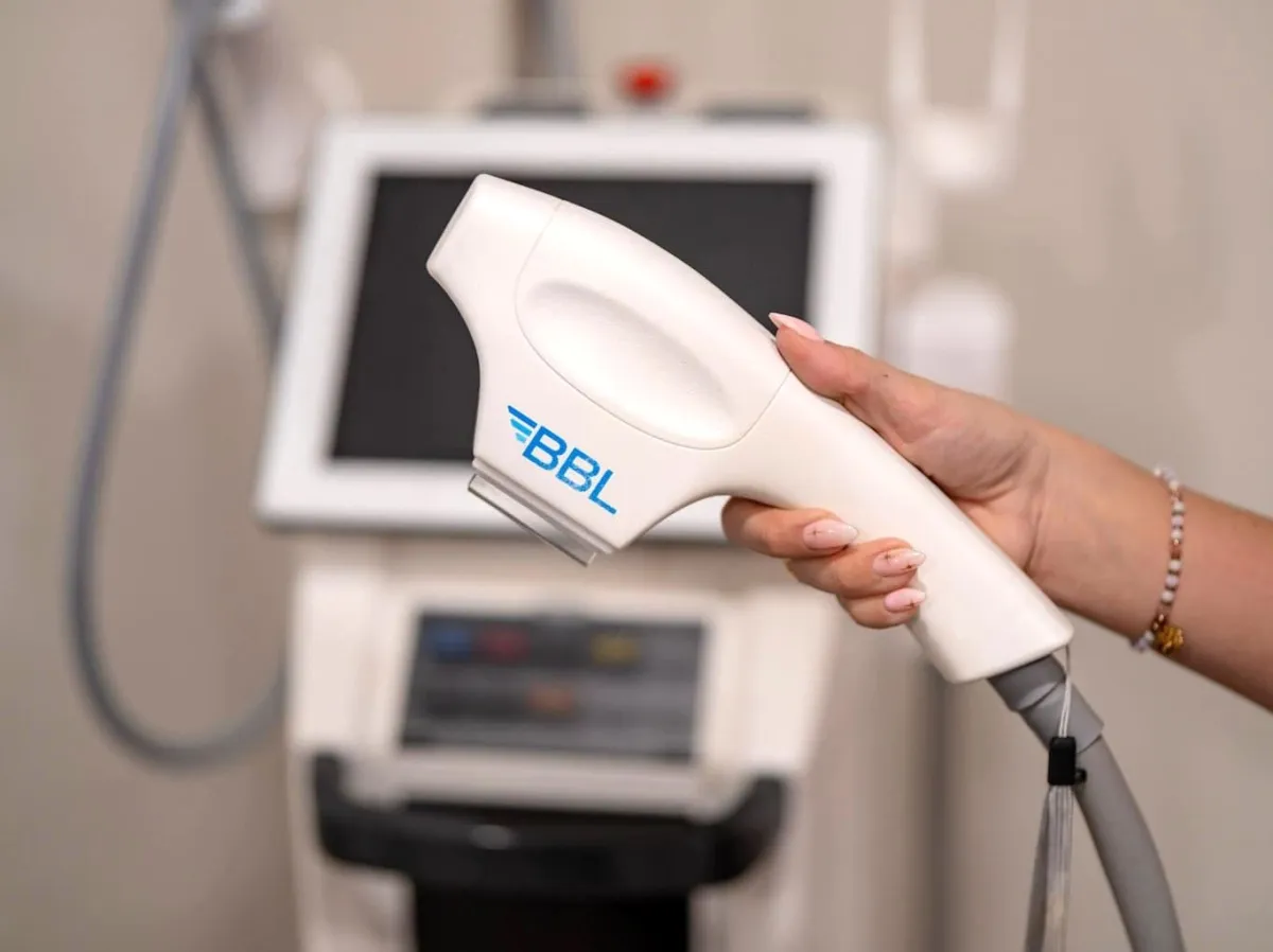 BBL Laser Treatment My Skin St Pete My Skin Bradenton