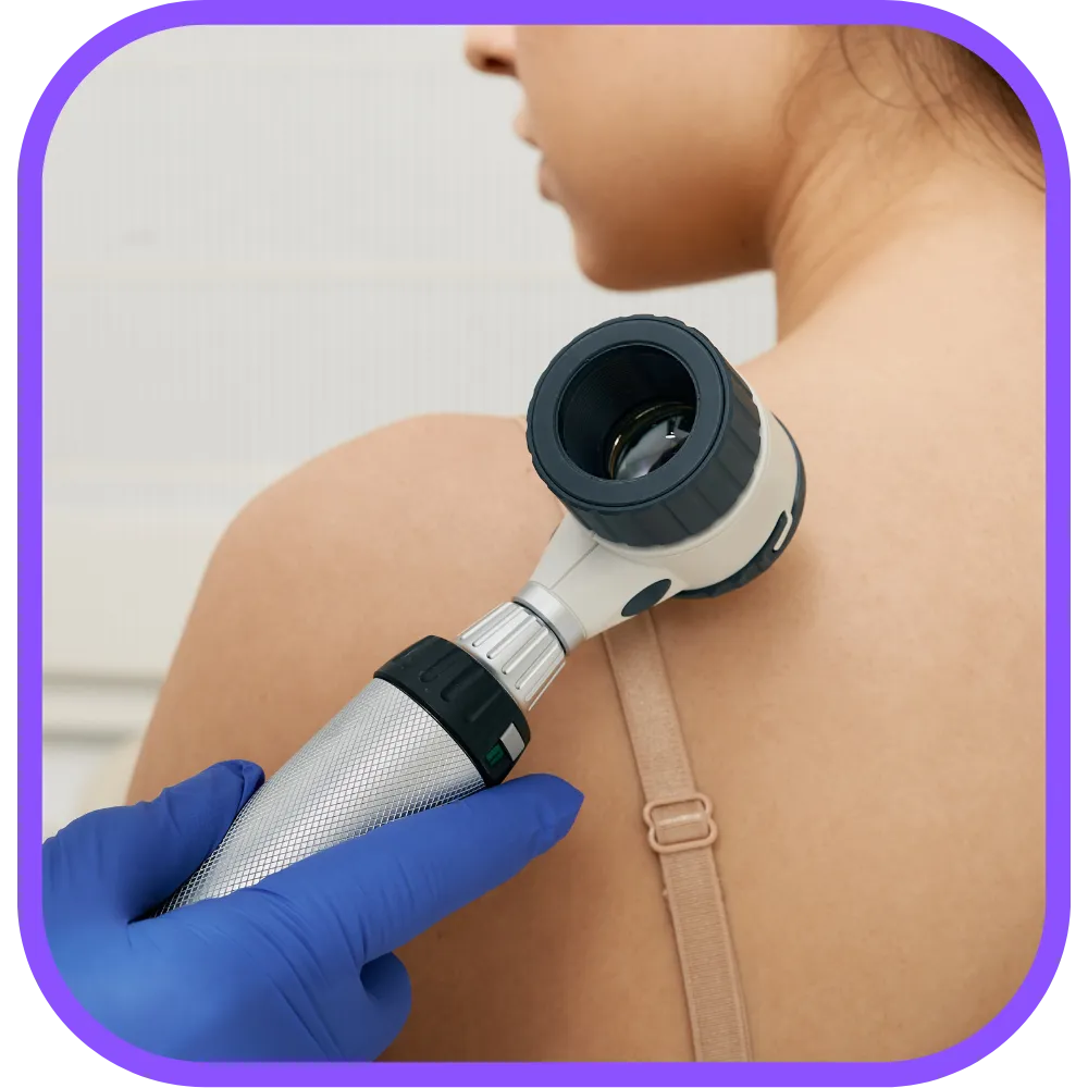 Skin Cancer Treatment in St Pete and Bradenton