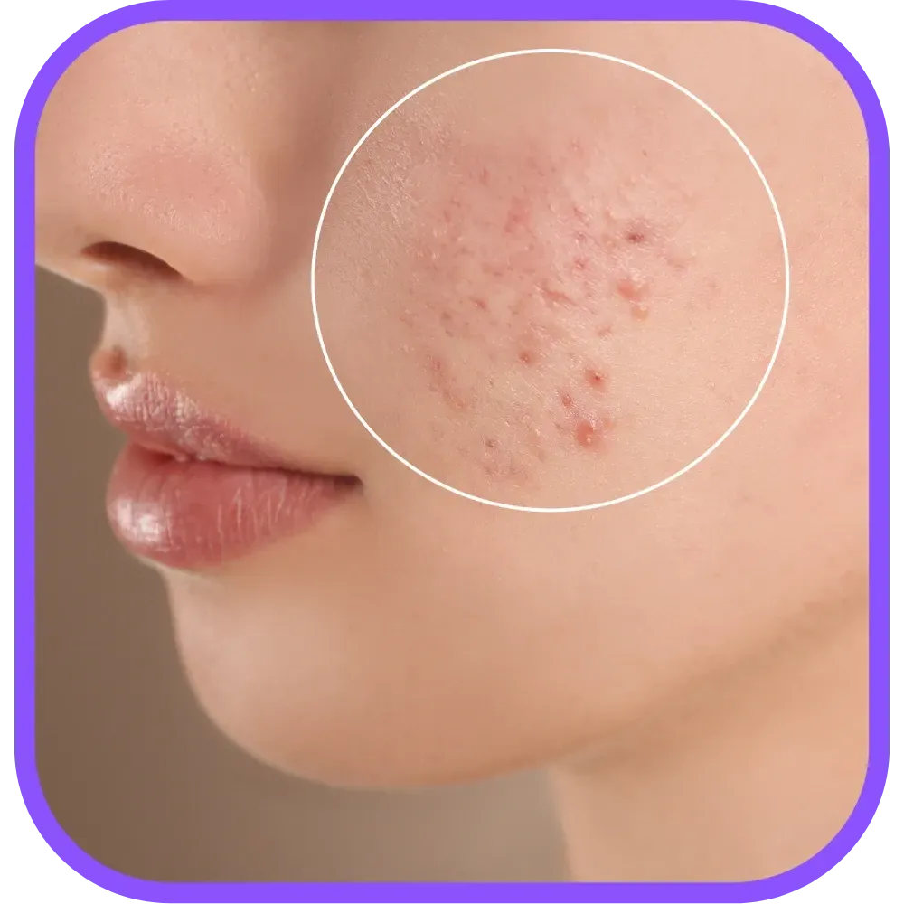 Medical Dermatology St. Pete and Bradenton My Skin