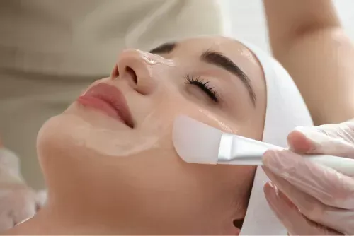 chemical peels st pete bradenton