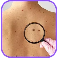 Surgical Dermatology St. Pete and Bradenton My Skin