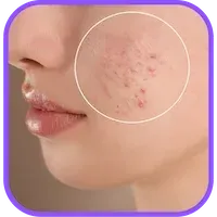 Medical Dermatology St. Pete and Bradenton My Skin