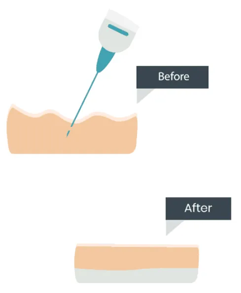 A graphic showing how Cellenis Derma PRP can help rejuvenate skin and slow down aging.