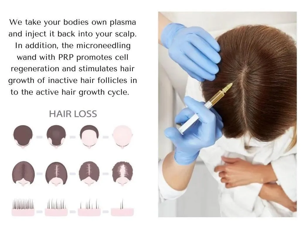 A diagram of hair regeneration using PRP and microneedling treatments.