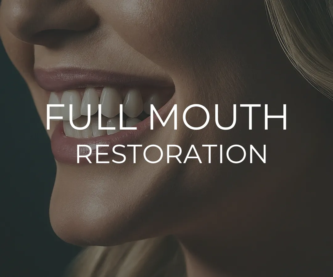 Full Mouth Reconstruction