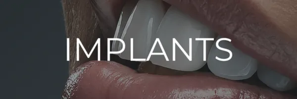 Dental Implants