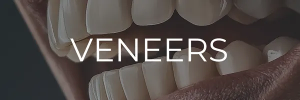 Veneers