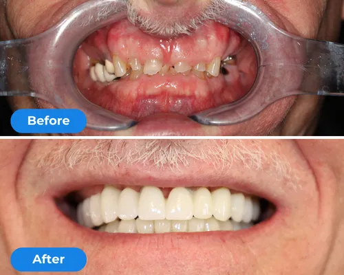 Full Mouth Reconstruction reviews