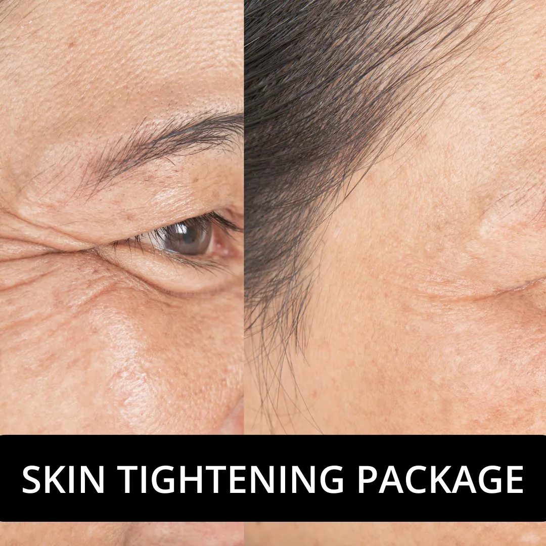 Skin tightening treatments fishtown pa