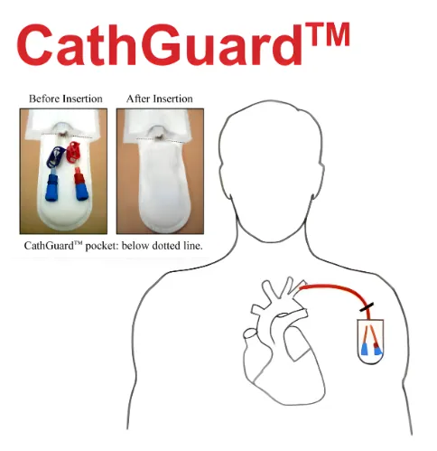 Ancillary & Disposables