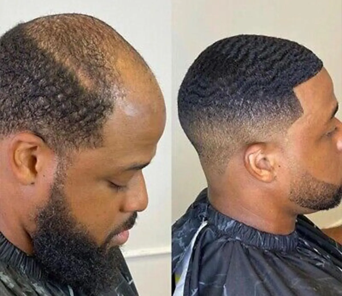 same day hair units new orleans