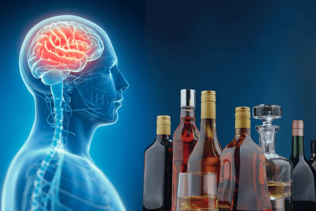 Alcohol and Brain Health: Understanding the Impact and Long-Term Risks