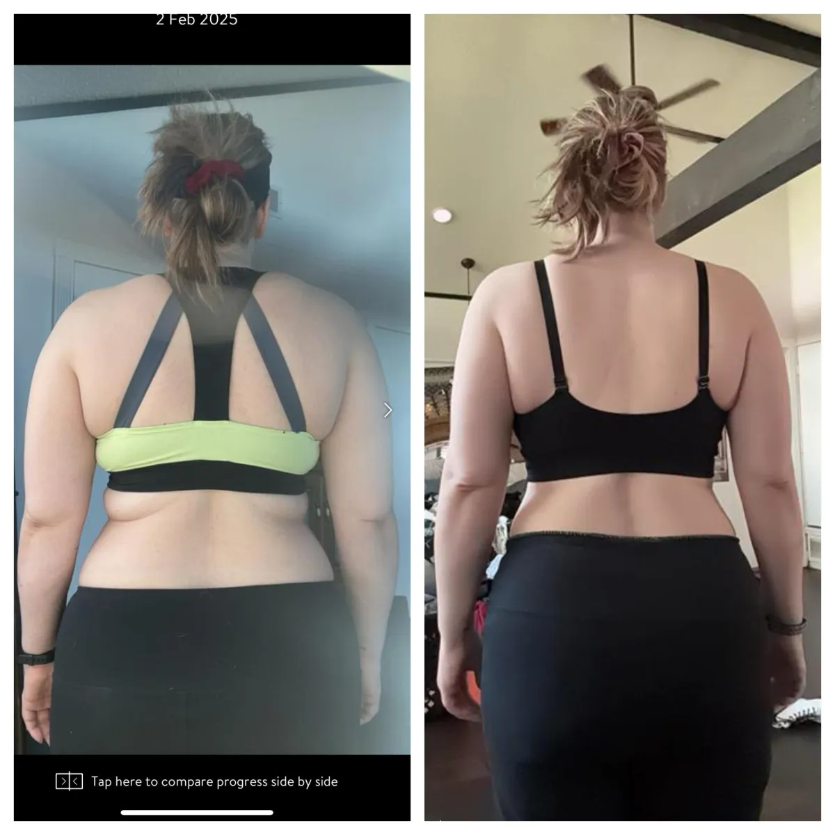 weight loss medication