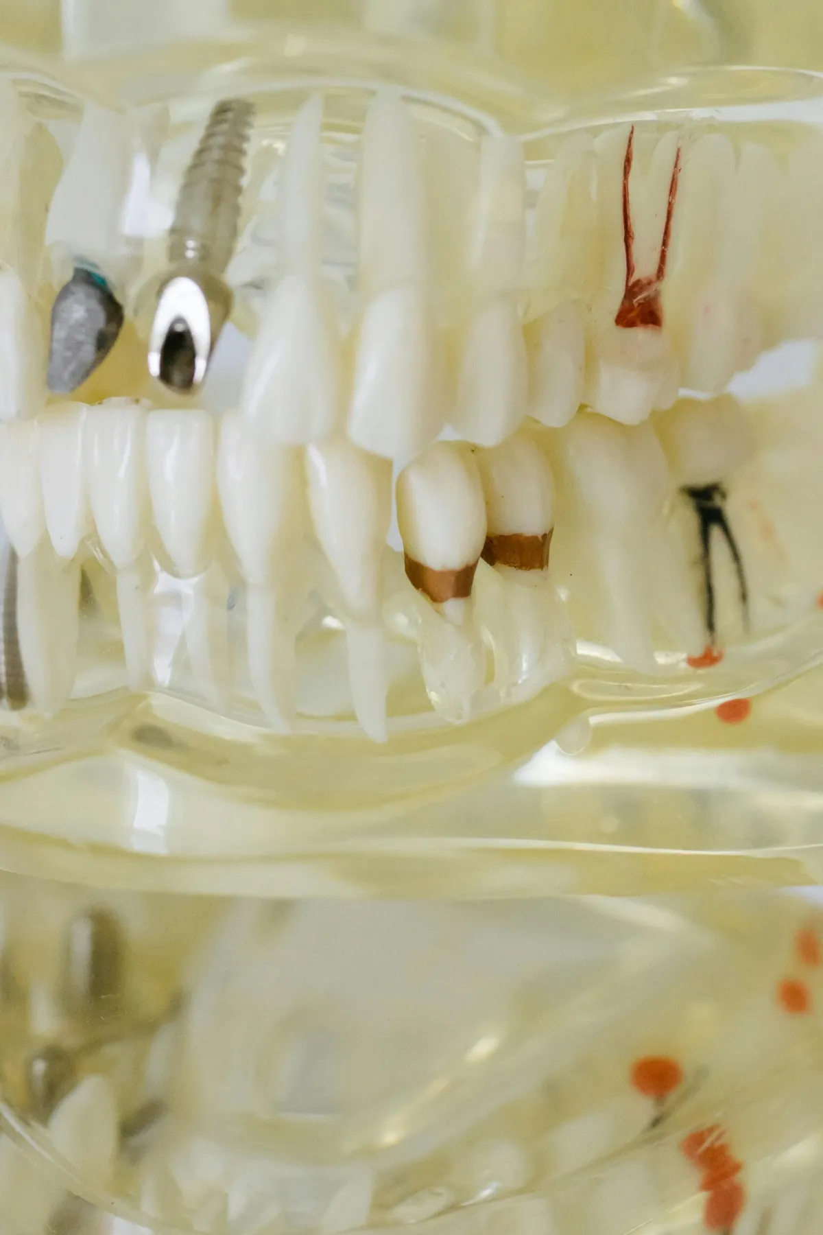 Lady who got her teeth cleaned
